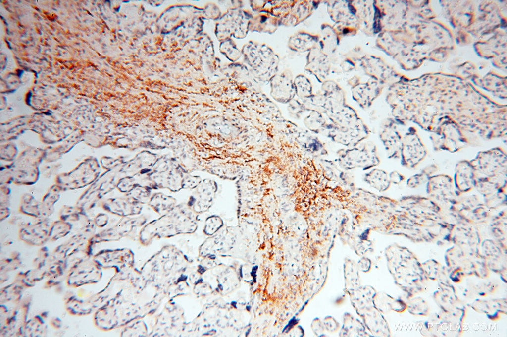 Immunohistochemistry (IHC) staining of human placenta tissue using CLCNKA Polyclonal antibody (14402-1-AP)