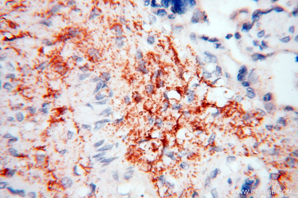 Immunohistochemistry (IHC) staining of human placenta tissue using CLCNKA Polyclonal antibody (14402-1-AP)