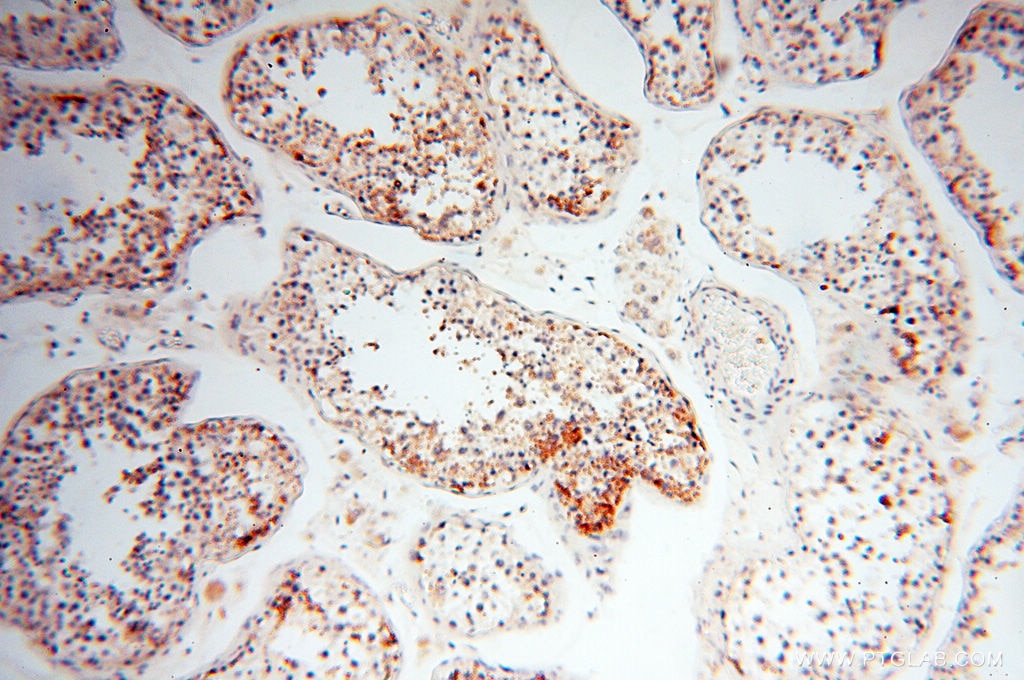 Immunohistochemistry (IHC) staining of human testis tissue using CLCNKA Polyclonal antibody (14402-1-AP)