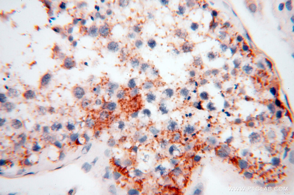IHC staining of human testis using 14402-1-AP