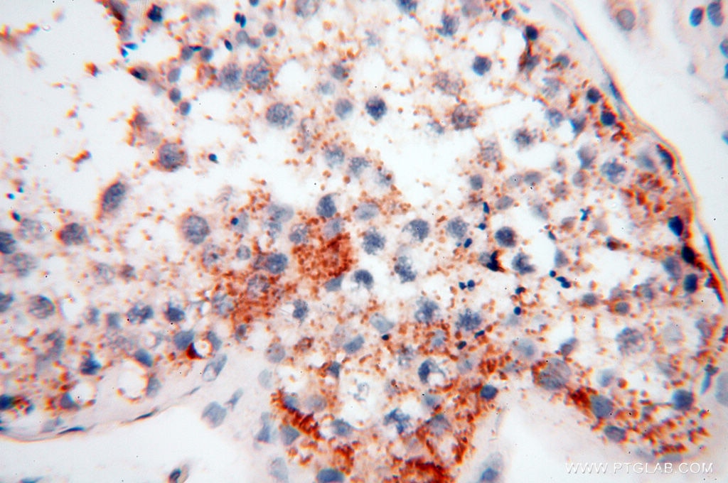 Immunohistochemistry (IHC) staining of human testis tissue using CLCNKA Polyclonal antibody (14402-1-AP)