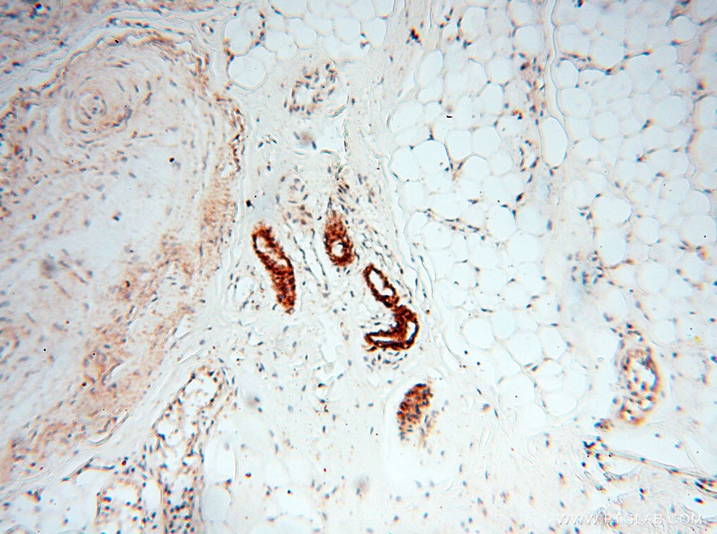 Immunohistochemistry (IHC) staining of human skin tissue using CLCNKA Polyclonal antibody (14402-1-AP)