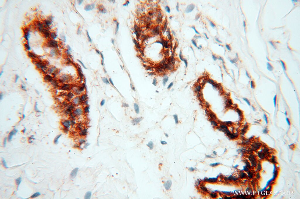 Immunohistochemistry (IHC) staining of human skin tissue using CLCNKA Polyclonal antibody (14402-1-AP)