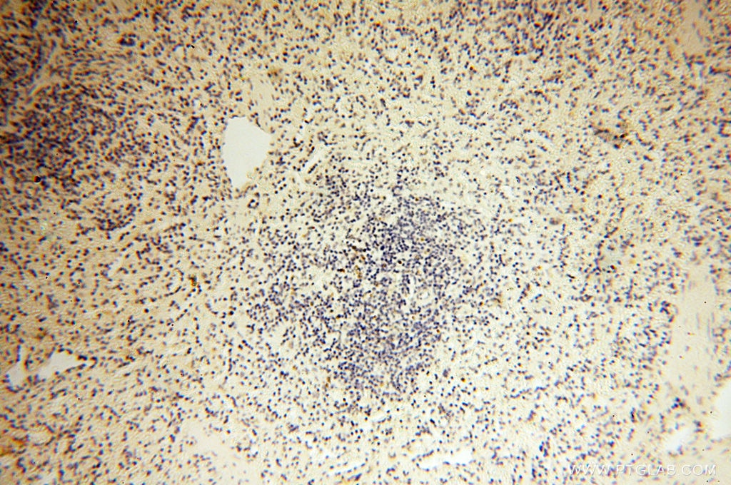 Immunohistochemistry (IHC) staining of human spleen tissue using CLCNKA Polyclonal antibody (14402-1-AP)