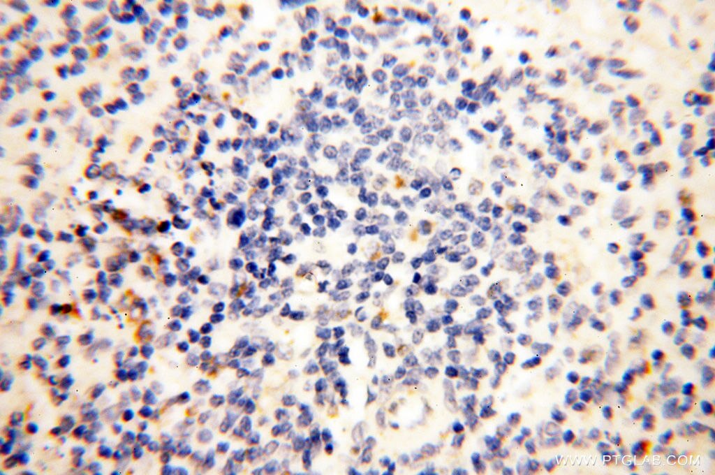 Immunohistochemistry (IHC) staining of human spleen tissue using CLCNKA Polyclonal antibody (14402-1-AP)