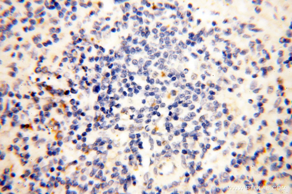 Immunohistochemistry (IHC) staining of human spleen tissue using CLCNKA Polyclonal antibody (14402-1-AP)