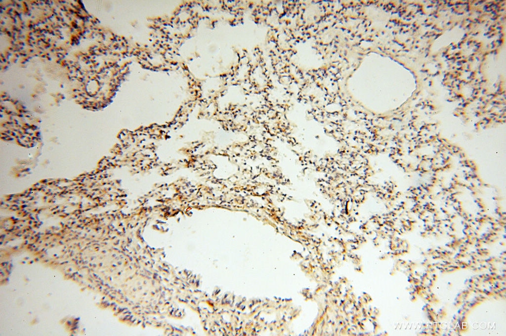 IHC staining of human lung using 14402-1-AP