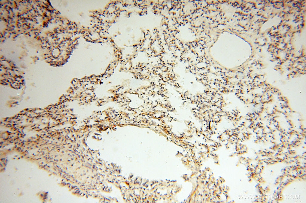 Immunohistochemistry (IHC) staining of human lung tissue using CLCNKA Polyclonal antibody (14402-1-AP)