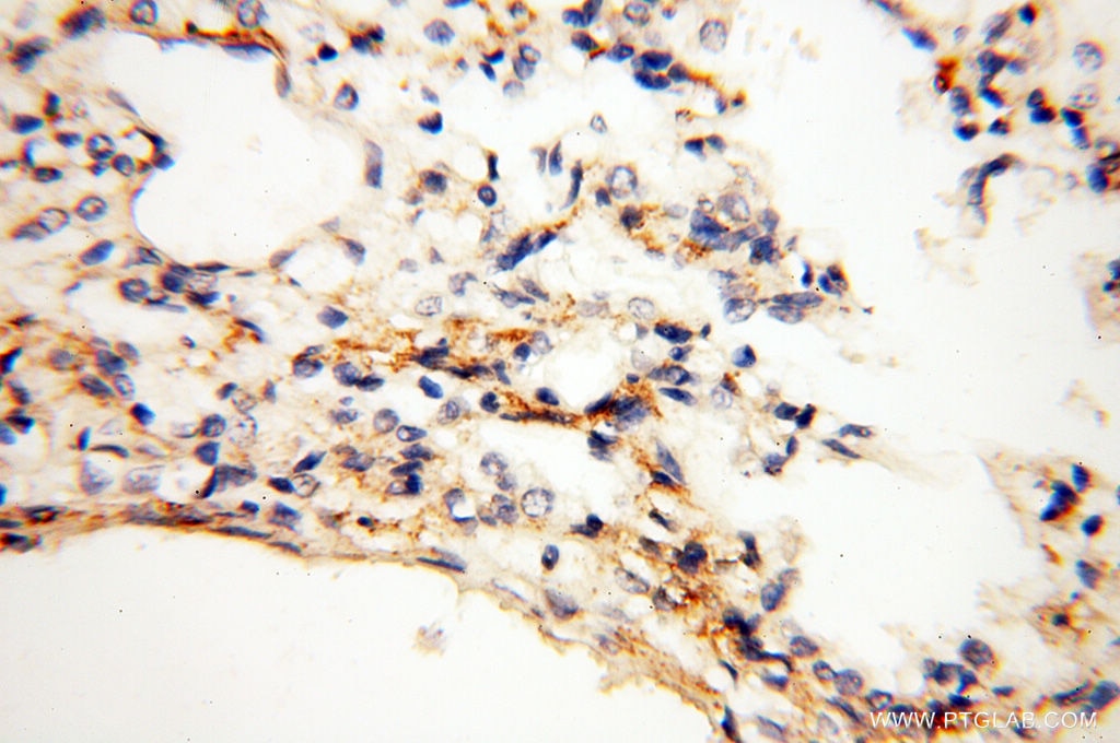 Immunohistochemistry (IHC) staining of human lung tissue using CLCNKA Polyclonal antibody (14402-1-AP)