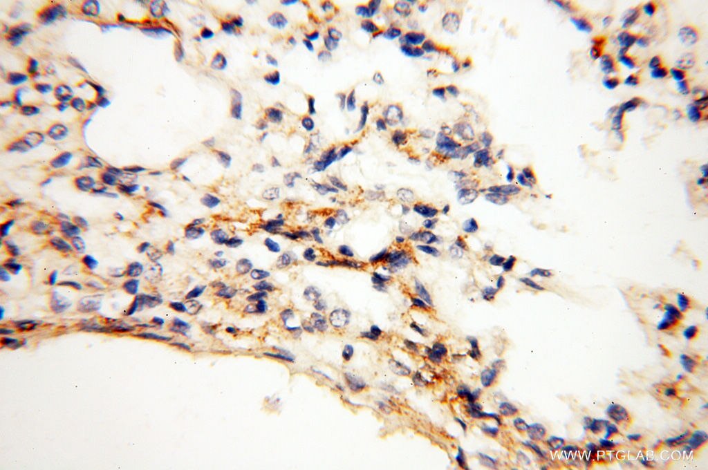 IHC staining of human lung using 14402-1-AP