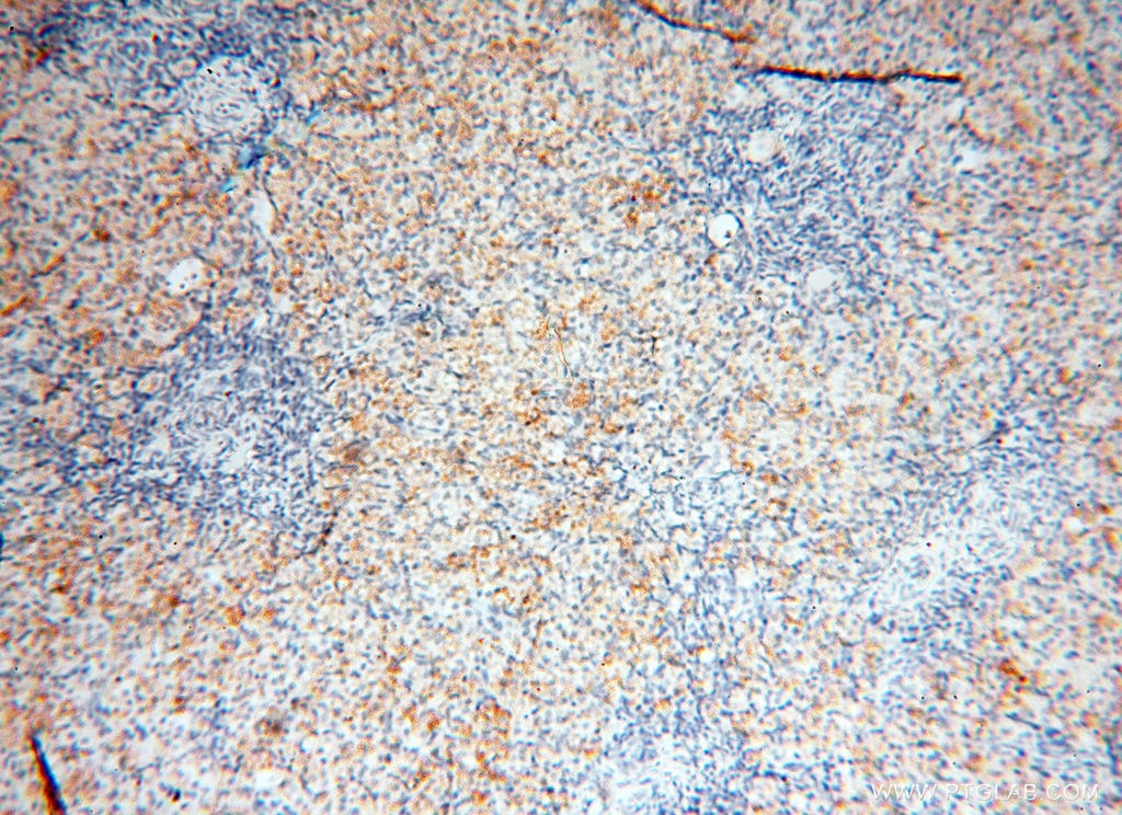 Immunohistochemistry (IHC) staining of human ovary tissue using CLCNKA Polyclonal antibody (14402-1-AP)