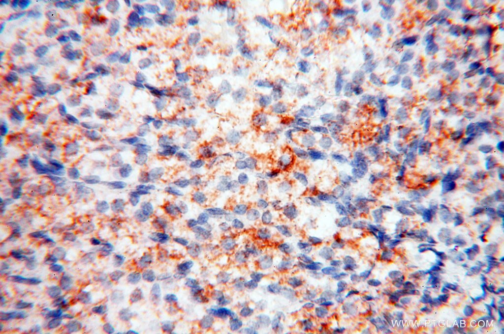 Immunohistochemistry (IHC) staining of human ovary tissue using CLCNKA Polyclonal antibody (14402-1-AP)