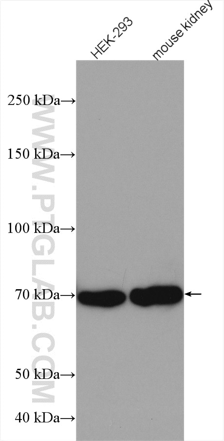 Western Blot (WB) analysis of various lysates using CLCNKA Polyclonal antibody (14402-1-AP)