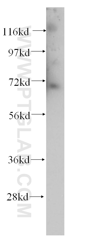 Western Blot (WB) analysis of human kidney tissue using CLCNKA Polyclonal antibody (14402-1-AP)