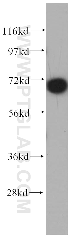 Western Blot (WB) analysis of mouse pancreas tissue using CLCNKA Polyclonal antibody (14402-1-AP)