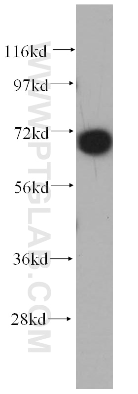 WB analysis of mouse pancreas using 14402-1-AP