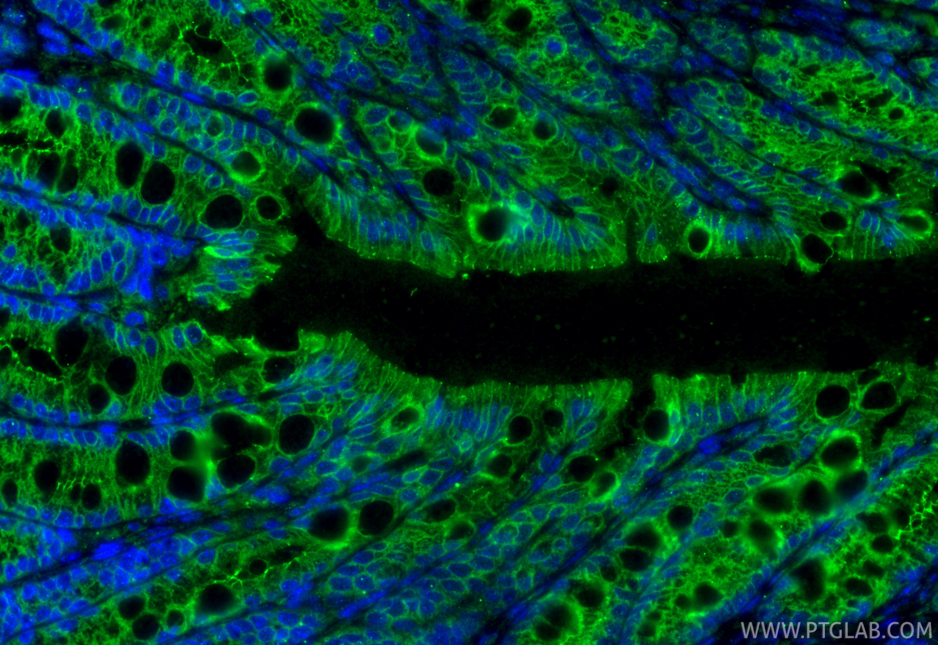 Immunofluorescence (IF) / fluorescent staining of mouse colon tissue using Claudin 1 Polyclonal antibody (13050-1-AP)