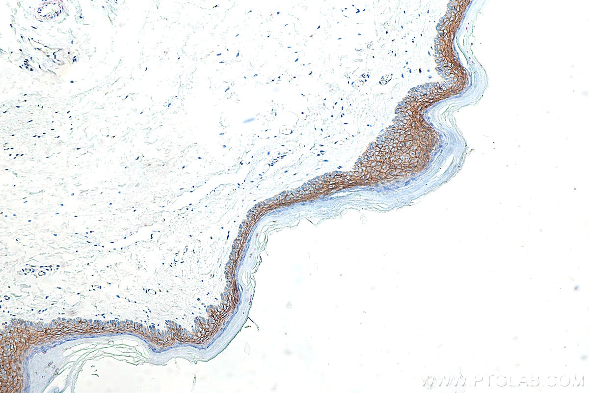 IHC staining of mouse skin using 13050-1-AP