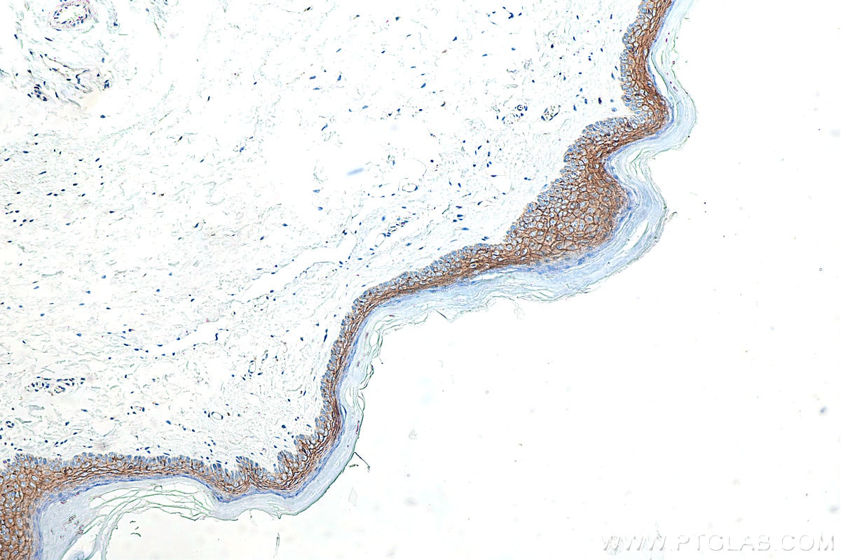 Immunohistochemistry (IHC) staining of mouse skin tissue using Claudin 1 Polyclonal antibody (13050-1-AP)