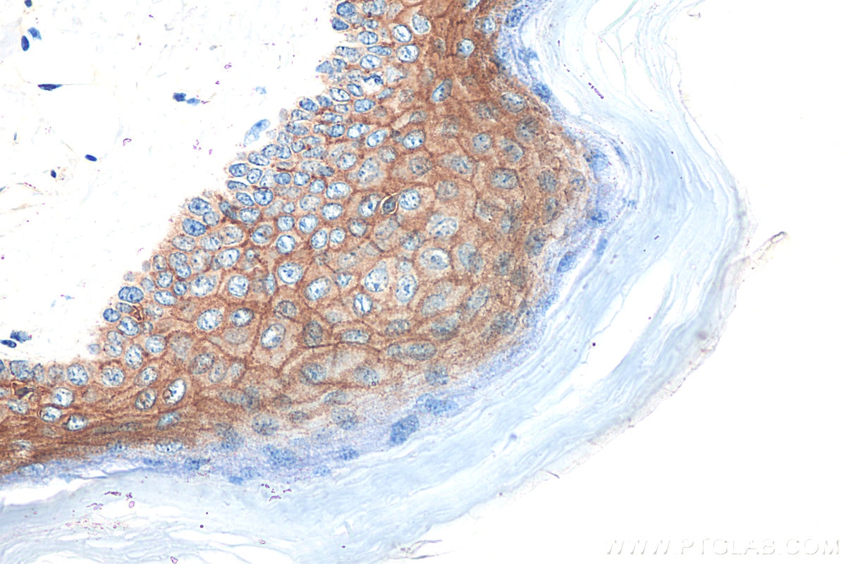 Immunohistochemistry (IHC) staining of mouse skin tissue using Claudin 1 Polyclonal antibody (13050-1-AP)