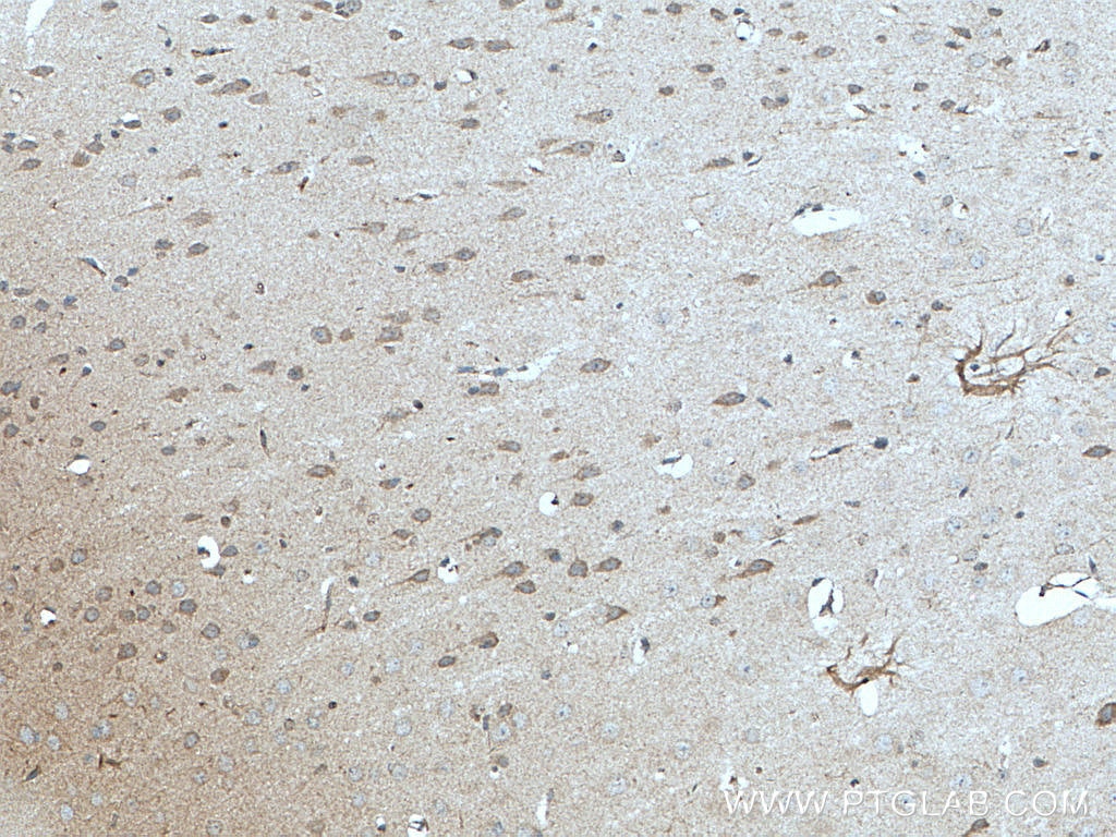 Immunohistochemistry (IHC) staining of mouse brain tissue using Claudin 11 Polyclonal antibody (12152-1-AP)