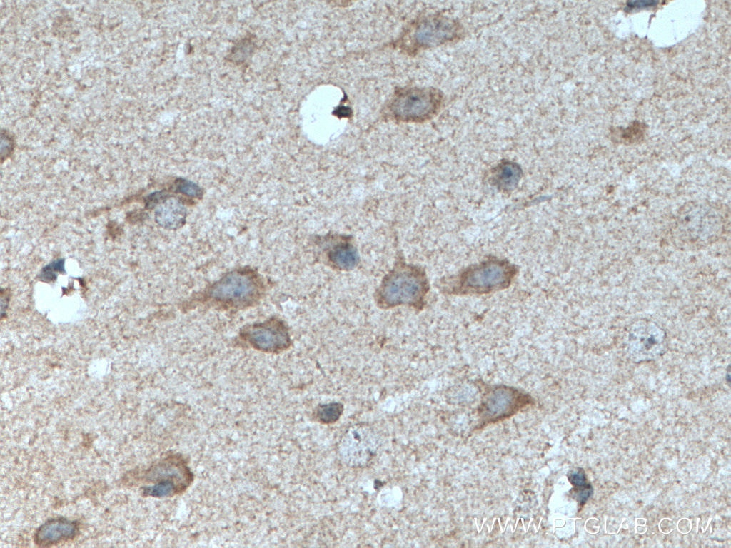 Immunohistochemistry (IHC) staining of mouse brain tissue using Claudin 11 Polyclonal antibody (12152-1-AP)