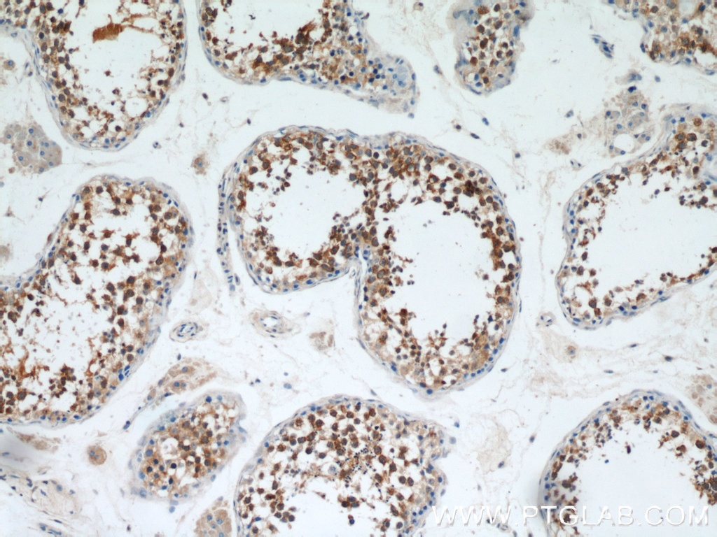 Immunohistochemistry (IHC) staining of human testis tissue using Claudin 11 Polyclonal antibody (12152-1-AP)
