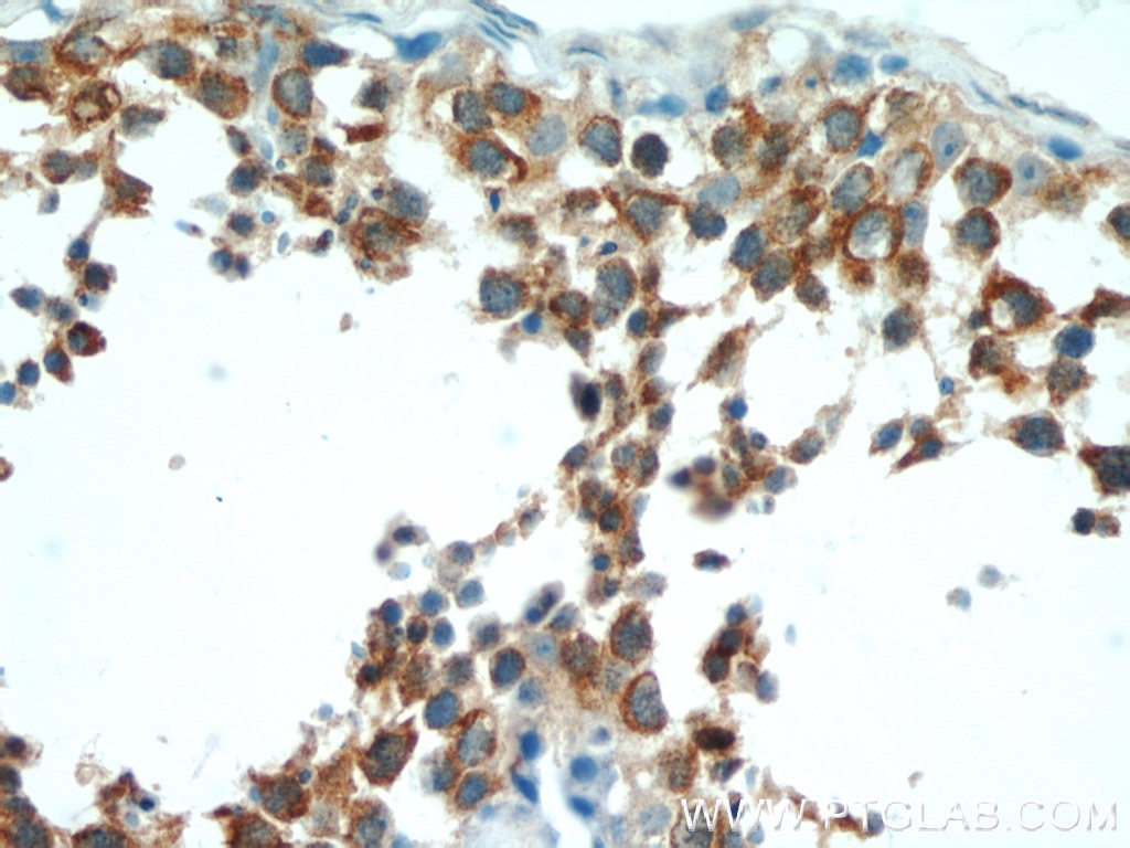 Immunohistochemistry (IHC) staining of human testis tissue using Claudin 11 Polyclonal antibody (12152-1-AP)