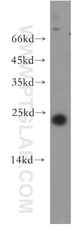 Western Blot (WB) analysis of human testis tissue using Claudin 11 Polyclonal antibody (12152-1-AP)