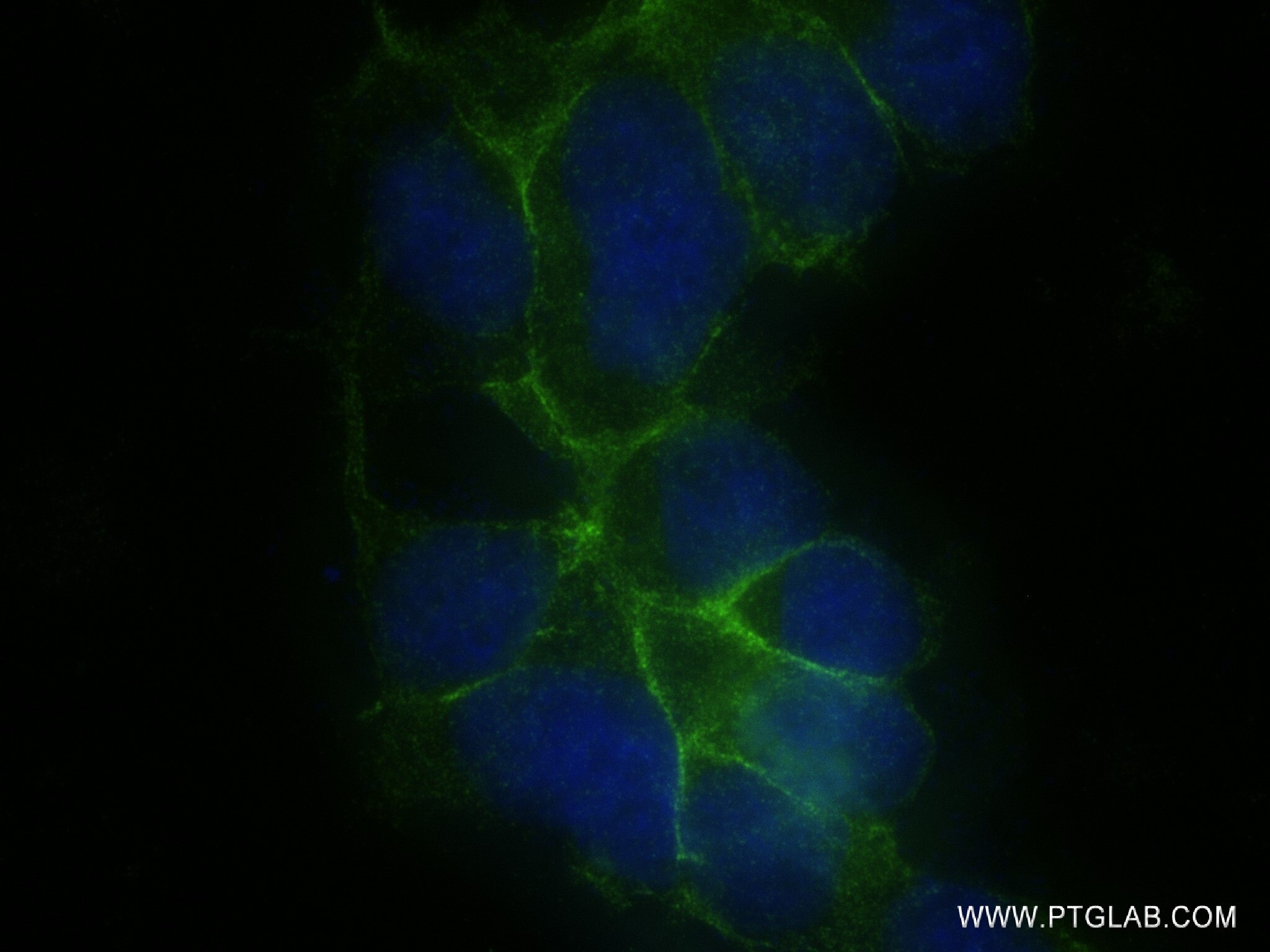 Immunofluorescence (IF) / fluorescent staining of HEK-293 cells using CLDN16 Recombinant antibody (82954-1-RR)