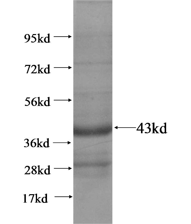 CLDN16 fusion protein Ag14929 SDS-PAGE
