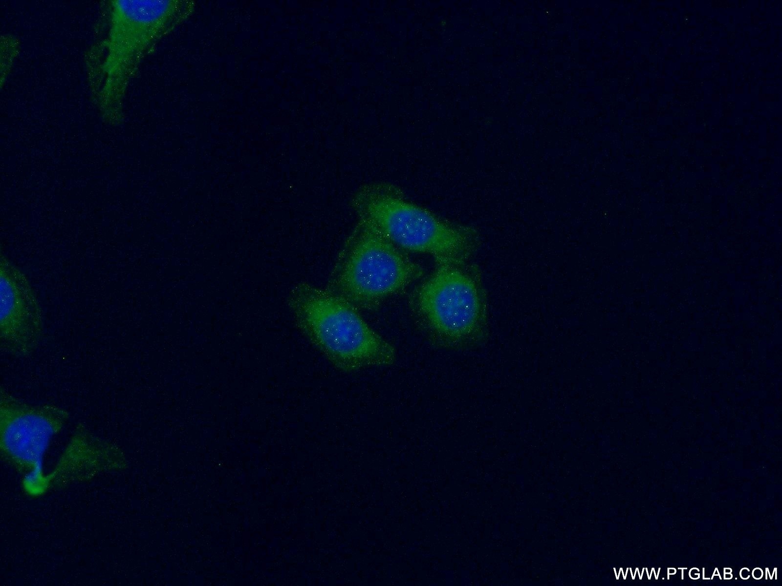 Immunofluorescence (IF) / fluorescent staining of MKN-45 cells using Claudin 18 Polyclonal antibody (21126-1-AP)