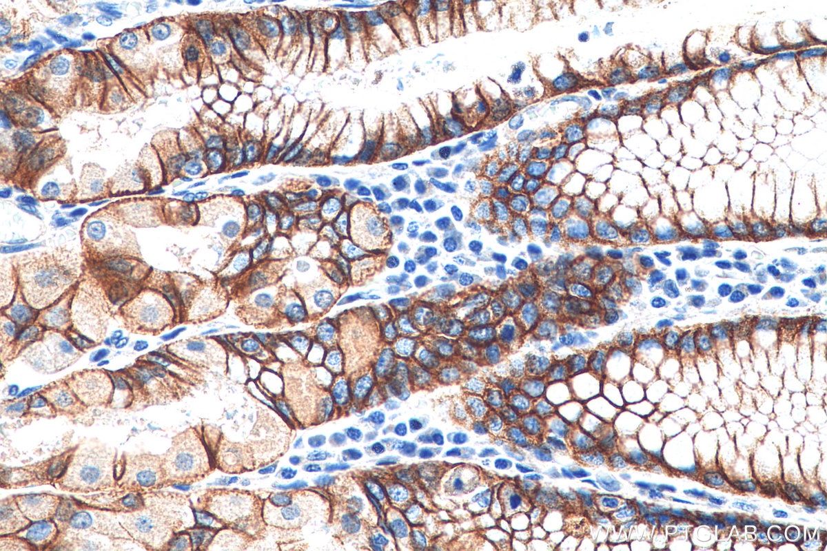 Immunohistochemistry (IHC) staining of human stomach tissue using Claudin 18 Polyclonal antibody (21126-1-AP)