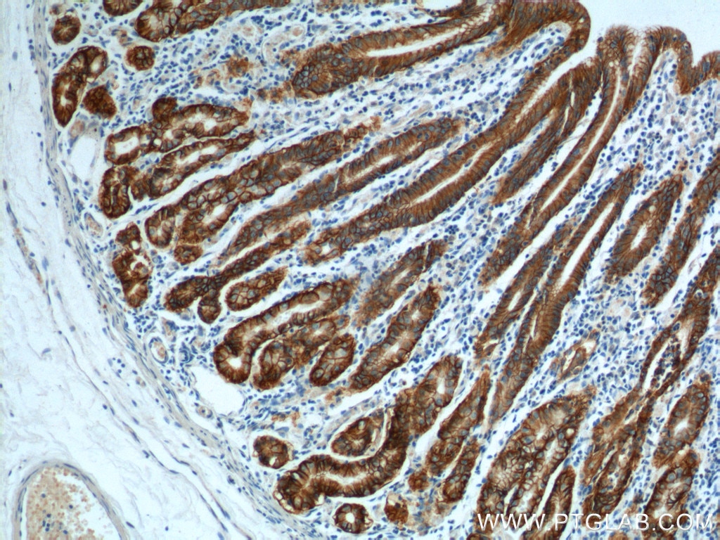 Immunohistochemistry (IHC) staining of human stomach tissue using Claudin 18 Polyclonal antibody (21126-1-AP)