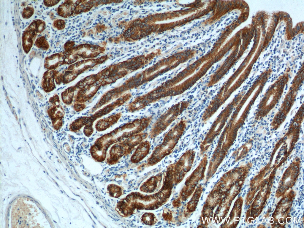 IHC staining of human stomach using 21126-1-AP