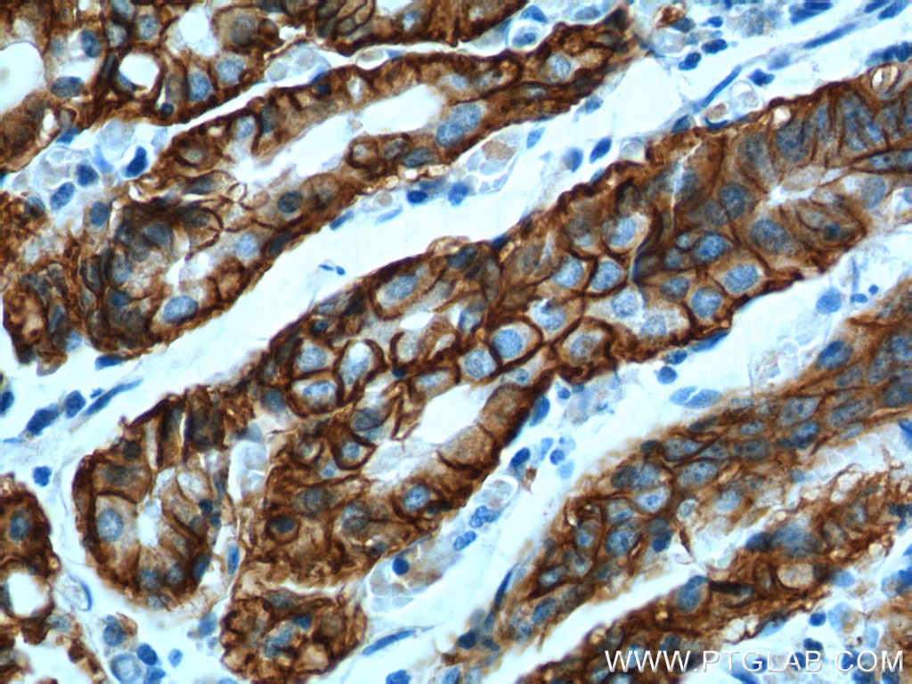 Immunohistochemistry (IHC) staining of human stomach tissue using Claudin 18 Polyclonal antibody (21126-1-AP)