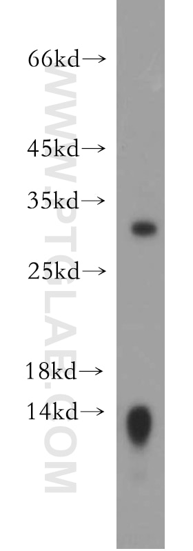 Western Blot (WB) analysis of mouse kidney tissue using Claudin 18 Polyclonal antibody (21126-1-AP)