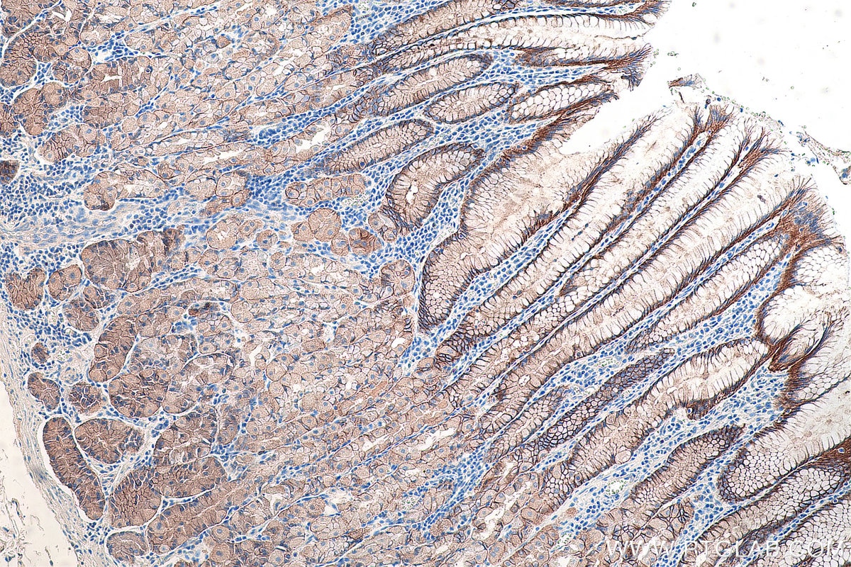 Immunohistochemistry (IHC) staining of human stomach tissue using Claudin 18 Monoclonal antibody (66167-1-Ig)
