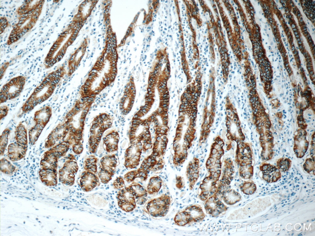 Immunohistochemistry (IHC) staining of human stomach tissue using Claudin 18 Monoclonal antibody (66167-1-Ig)