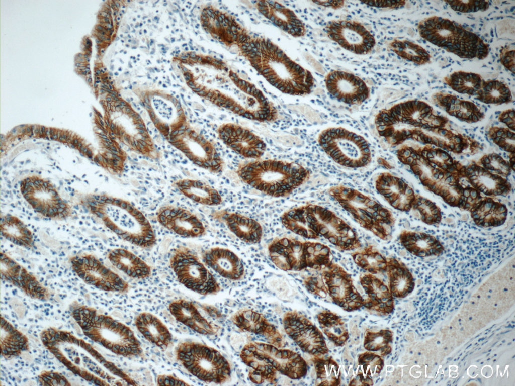 IHC staining of human stomach using 66167-1-Ig