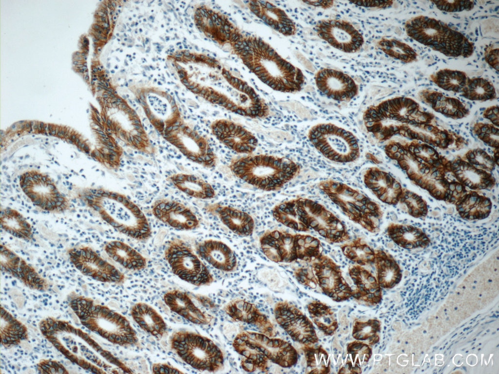 Immunohistochemistry (IHC) staining of human stomach tissue using Claudin 18 Monoclonal antibody (66167-1-Ig)