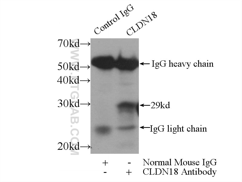 Immunoprecipitation (IP) experiment of mouse stomach tissue using Claudin 18 Monoclonal antibody (66167-1-Ig)