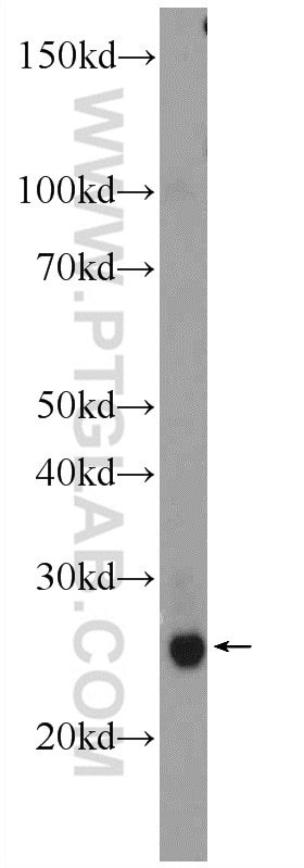 WB analysis of HepG2 using 11291-2-AP