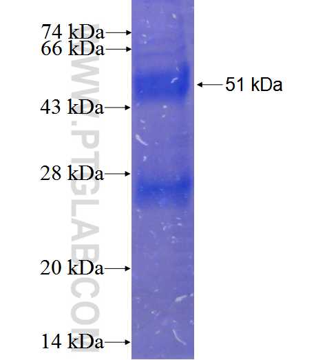 CLDN2 fusion protein Ag1866 SDS-PAGE