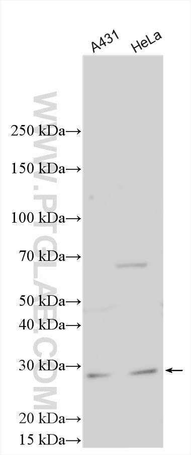 Western Blot (WB) analysis of various lysates using Claudin 22 Polyclonal antibody (20724-1-AP)
