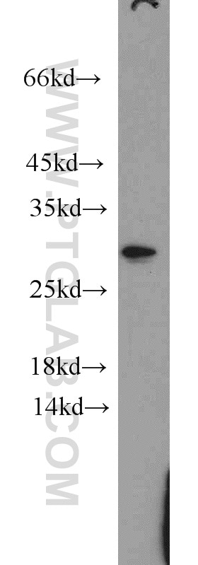 Western Blot (WB) analysis of HeLa cells using Claudin 22 Polyclonal antibody (20724-1-AP)
