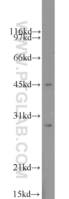 Western Blot (WB) analysis of A431 cells using Claudin 22 Polyclonal antibody (20724-1-AP)