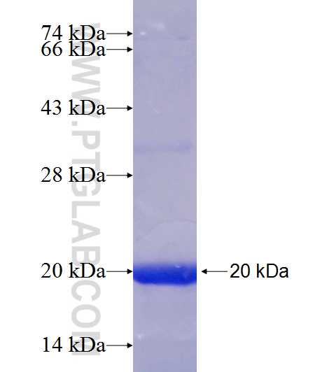 CLDN23 fusion protein Ag18520 SDS-PAGE