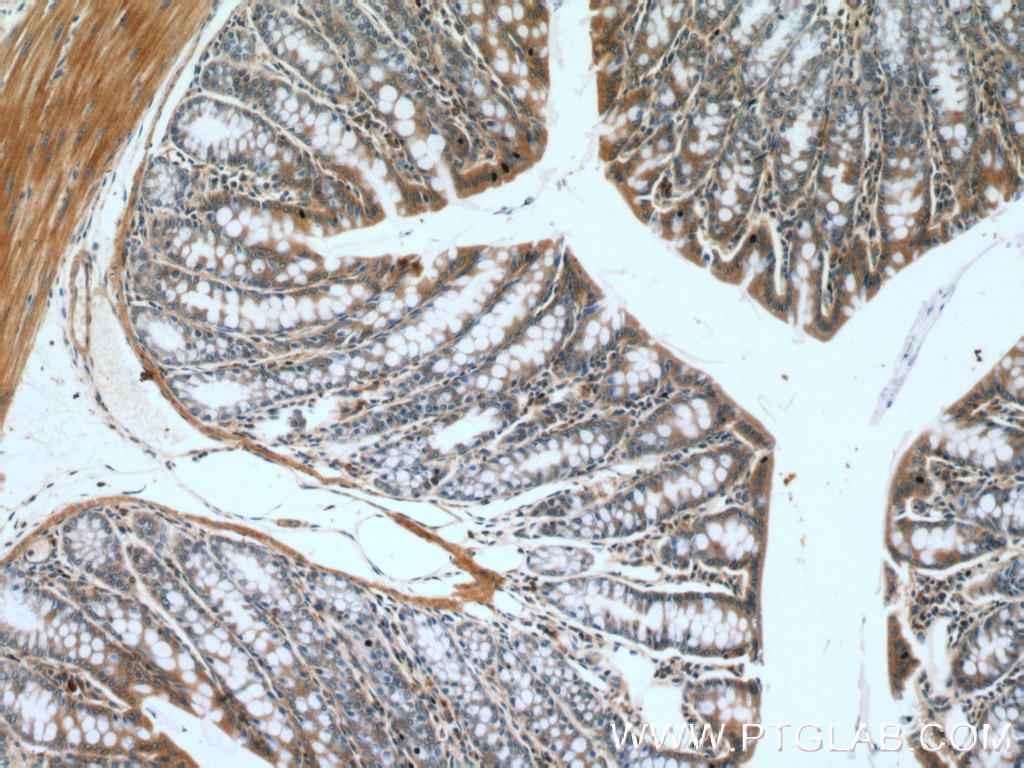 Immunohistochemistry (IHC) staining of mouse colon tissue using Claudin 3 Polyclonal antibody (16456-1-AP)