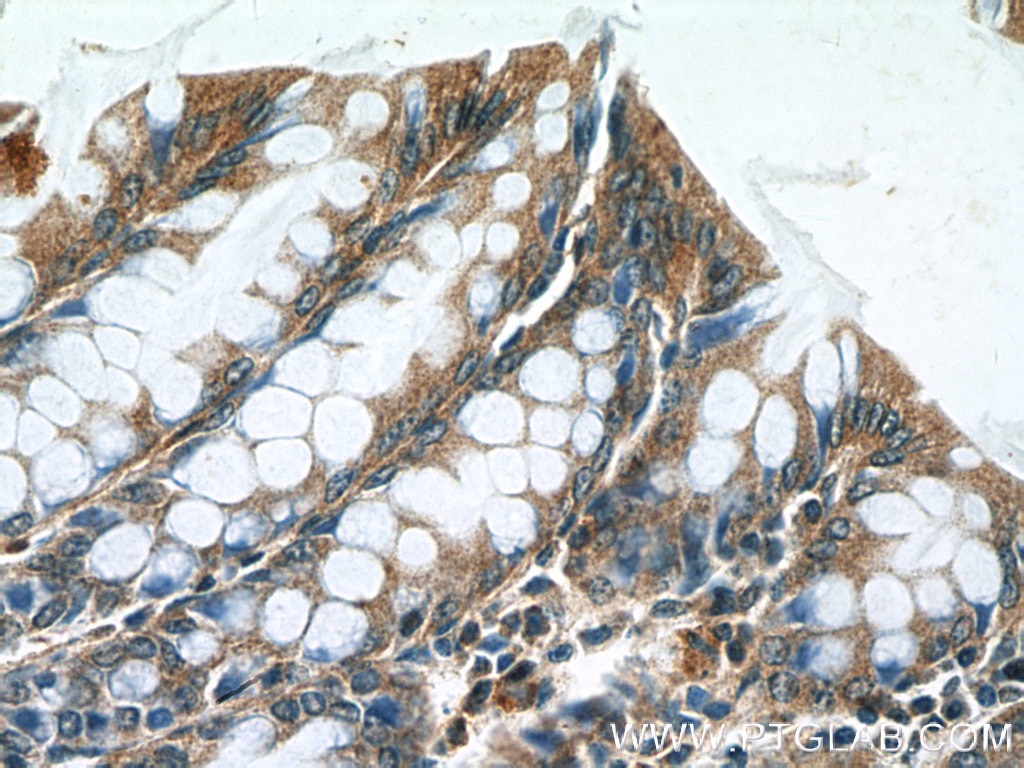 Immunohistochemistry (IHC) staining of mouse colon tissue using Claudin 3 Polyclonal antibody (16456-1-AP)